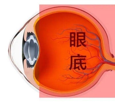 愛(ài)爾眼科：激光“打”在眼內(nèi)還能治眼病？